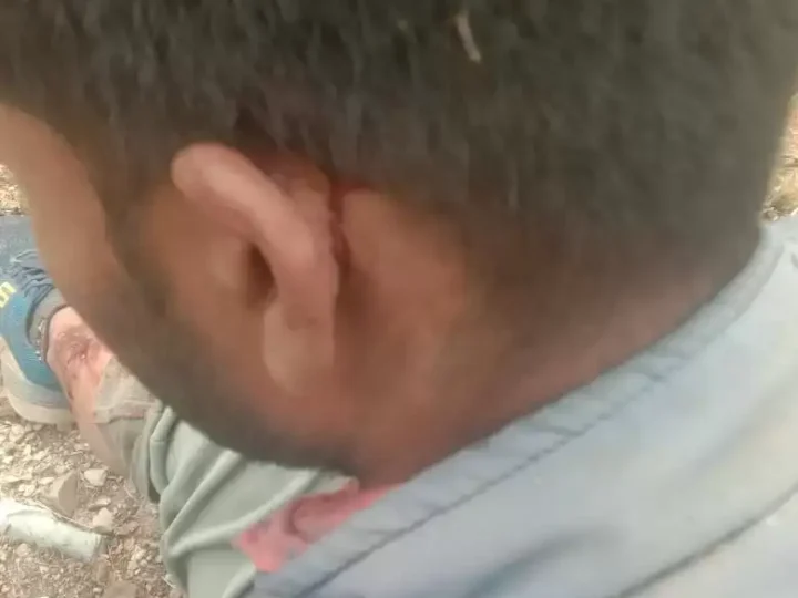 जुणगा गांव में ग्रामीण पर भालू ने किया जानलेवा हमला, बुरी तरह घायल