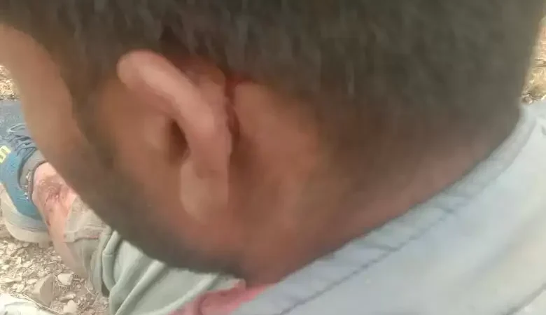 जुणगा गांव में ग्रामीण पर भालू ने किया जानलेवा हमला, बुरी तरह घायल