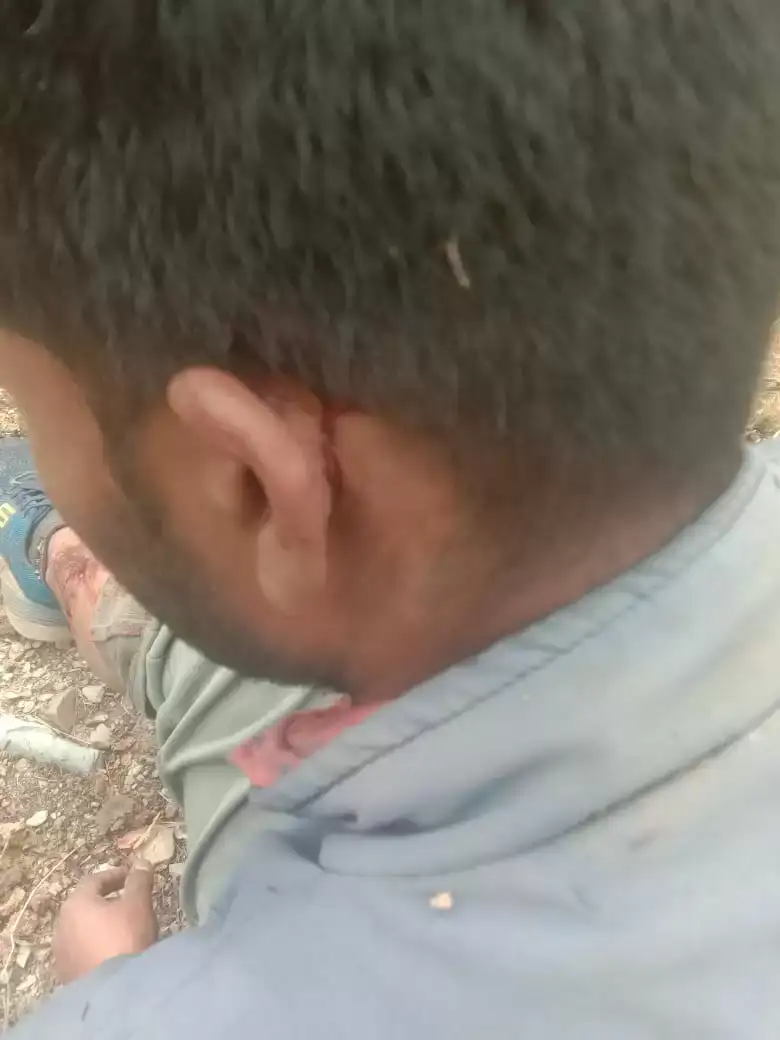 जुणगा गांव में ग्रामीण पर भालू ने किया जानलेवा हमला, बुरी तरह घायल